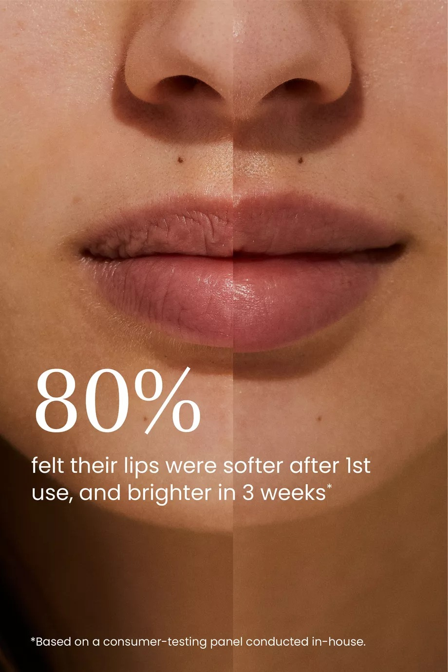 Aker Fassi-Hyaluronik Asitli Dudak ve Yanak Renklendirici 5.5ml