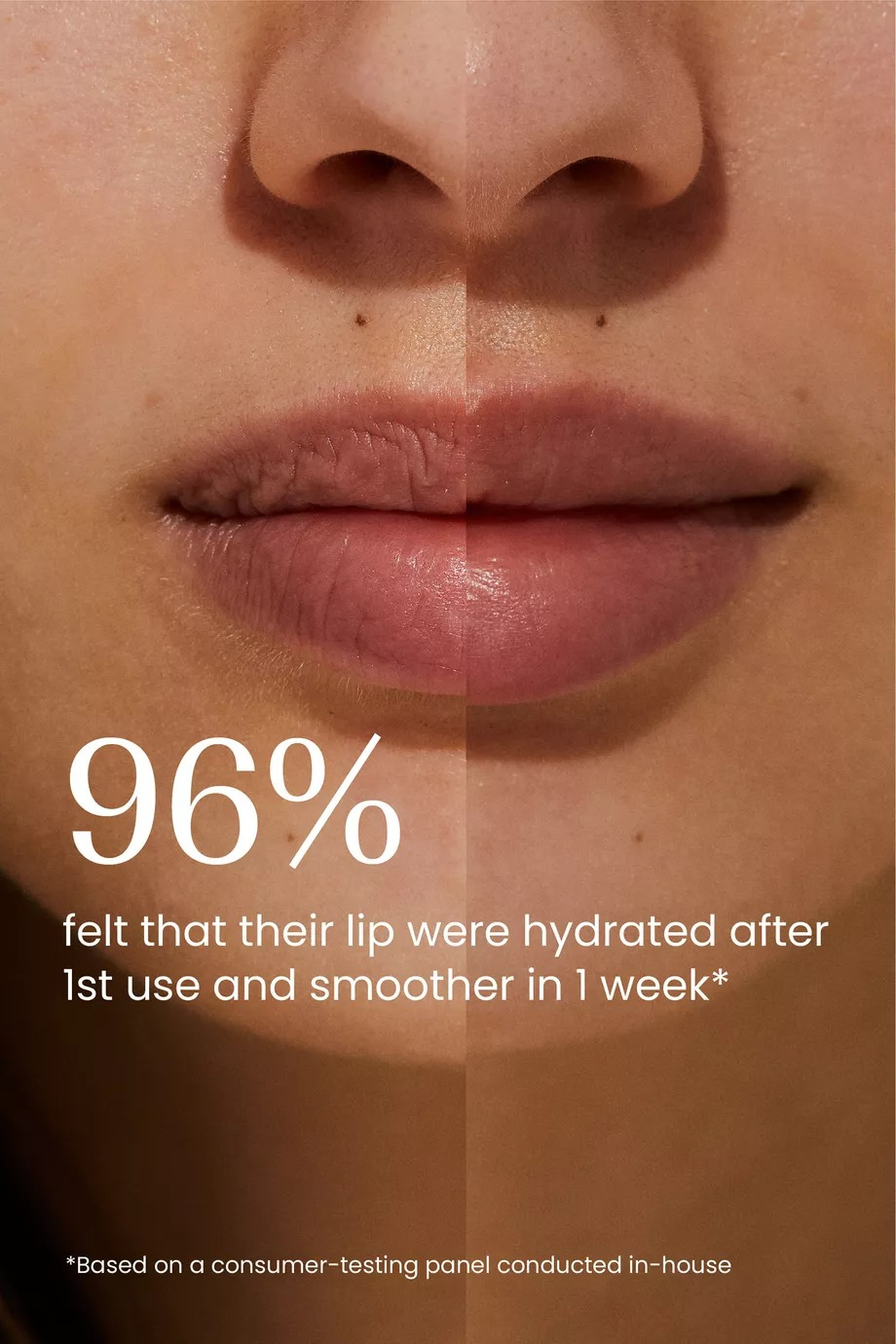 Aker Fassi Nemlendirici Dudak Balmı 12ml Besleyici ve Canlandırıcı