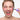 WONDERSKIN