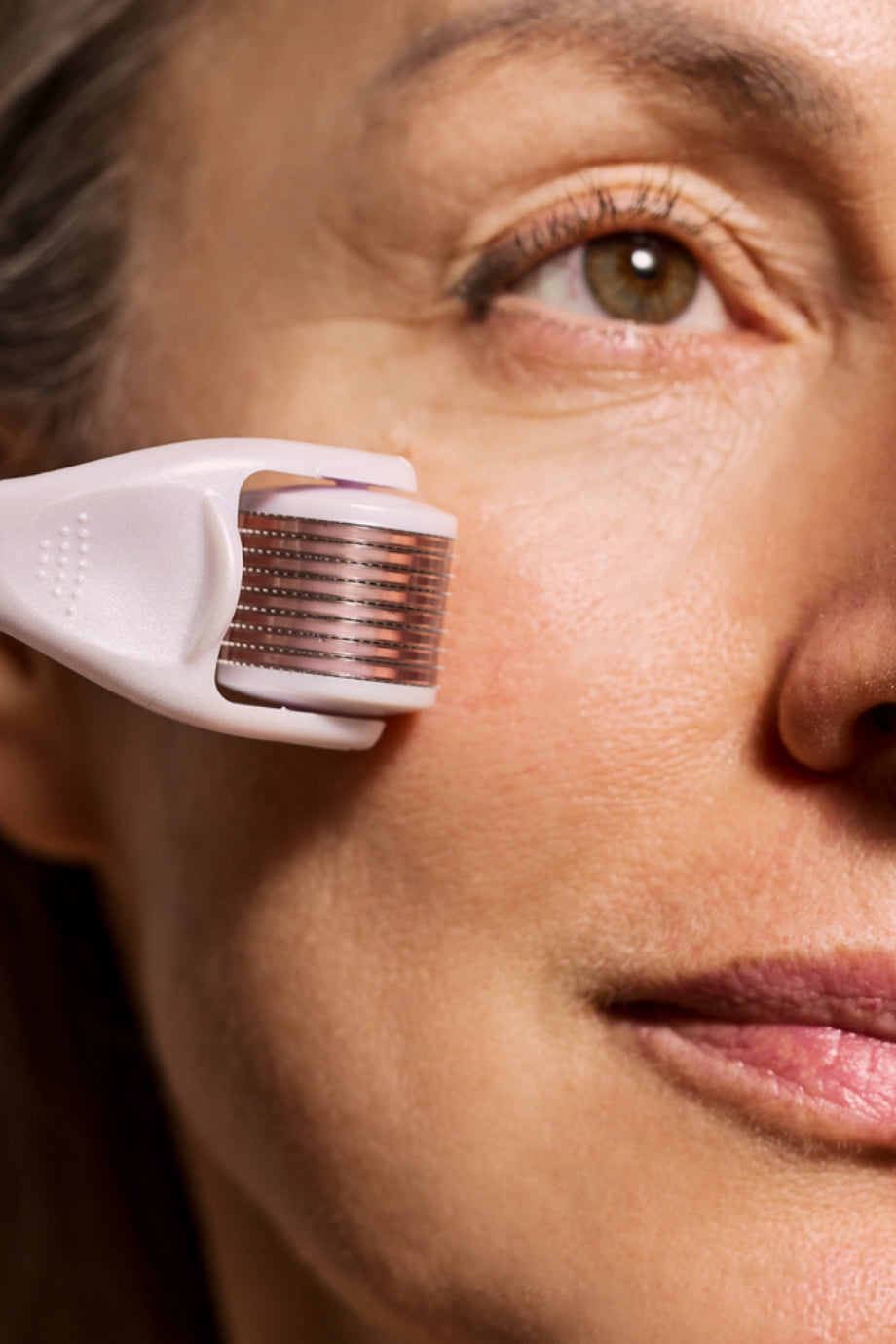 540 Titanyum Mikroiğneli Derma Roller 0.25 mm Yüz Yenileyici Cilt Bakım Aleti